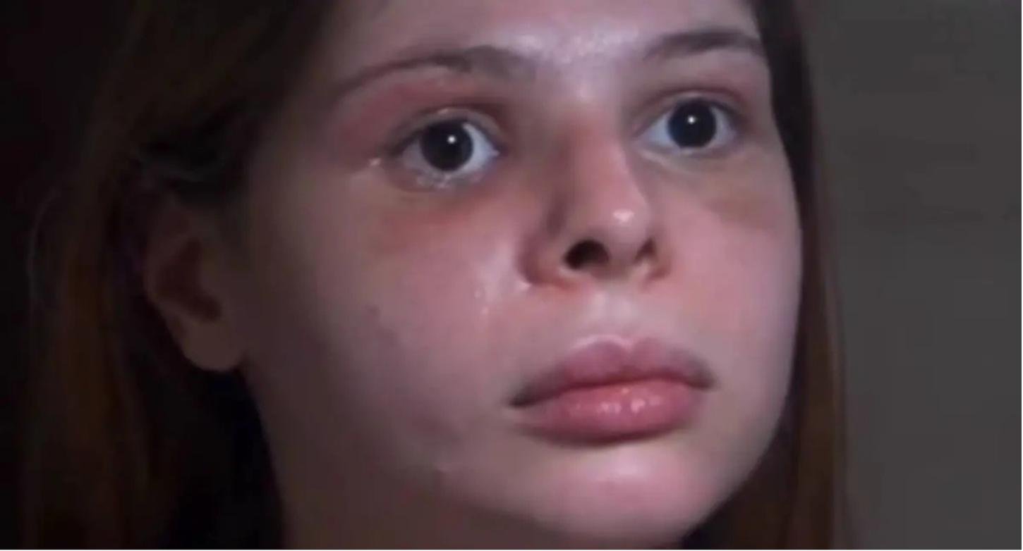 Médica é espancada por ex-namorado em SP