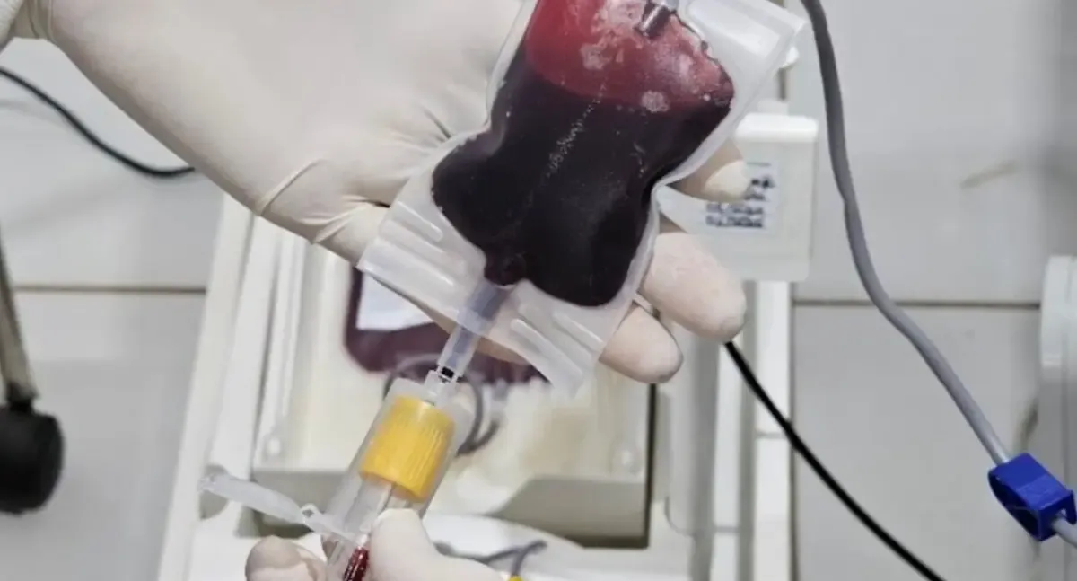 Fhemeron destaca importância da doação de medula óssea em Rondônia