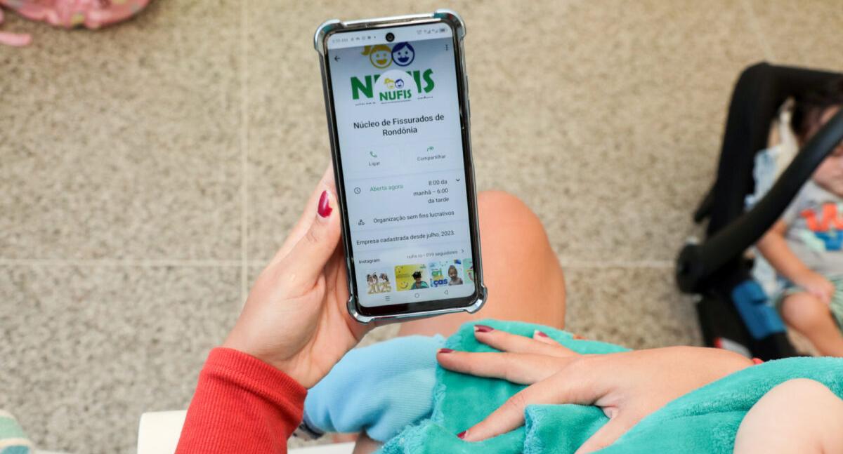 Nufis atende pacientes com fissura labiopalatina e oferece cuidado completo em Rondônia