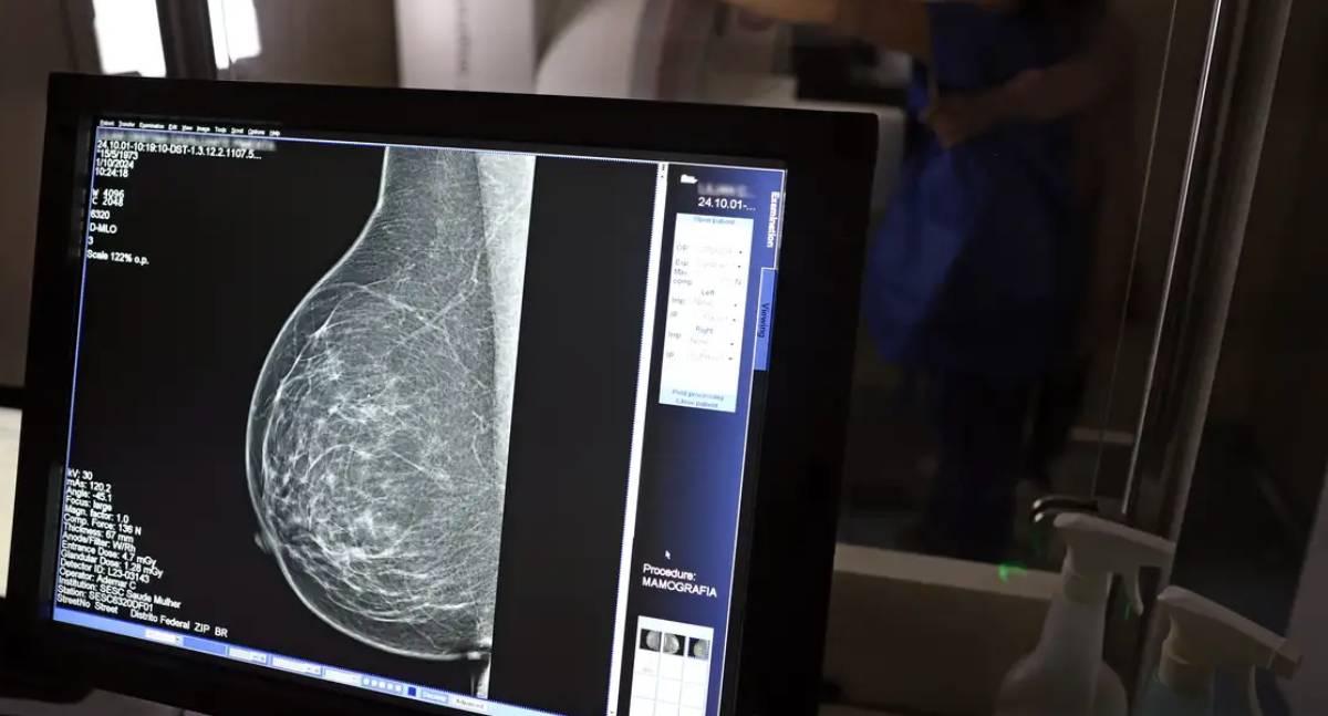 Câncer de mama: pacientes têm direito a benefícios do INSS durante o tratamento