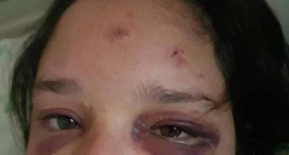 Mulher é espancada e ameaçada de morte pelo ex-marido em VilhenaMulher é espancada e ameaçada de morte pelo ex-marido em Vilhena