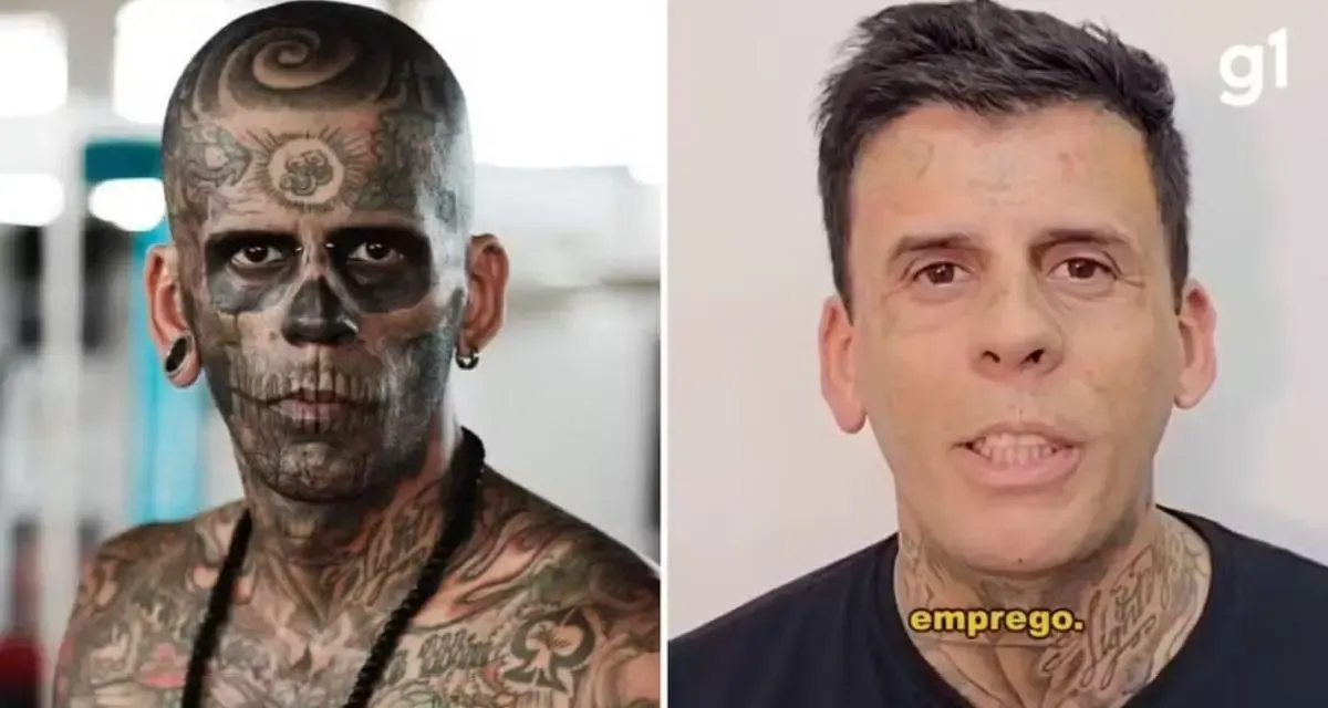 “Mais tatuado do Brasil” remove desenhos do corpo após se converter ao evangelho