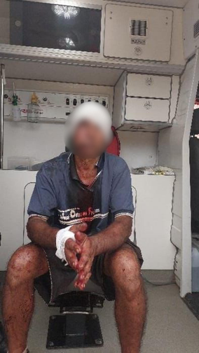 Homem é brutalmente agredido durante assalto na zona Leste de Porto Velho